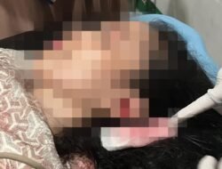 Oknum Anggota Brimob Diduga Aniaya Istrinya, Ditemukan Pingsan Hingga Alami Pendarahan